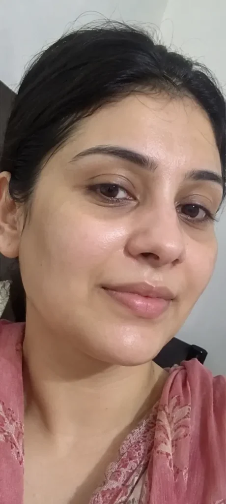 Dark Spots & Dull Skin after